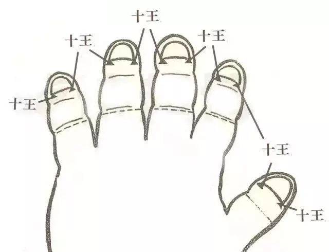 高烧惊厥| 宝宝惊厥不要慌,这样推拿可以救命!