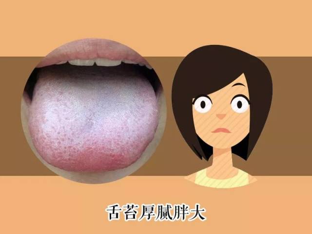 舌苔厚腻淡白有裂纹...看舌头知体质_搜狐网
