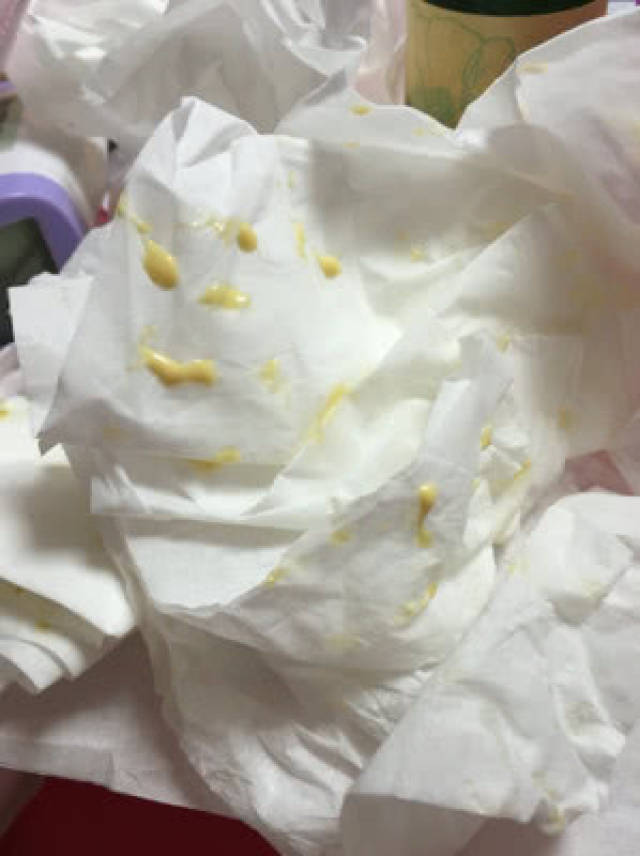 甚至有的断奶长达10年之久的妈妈,也会被美容院告知,乳房里还有残留