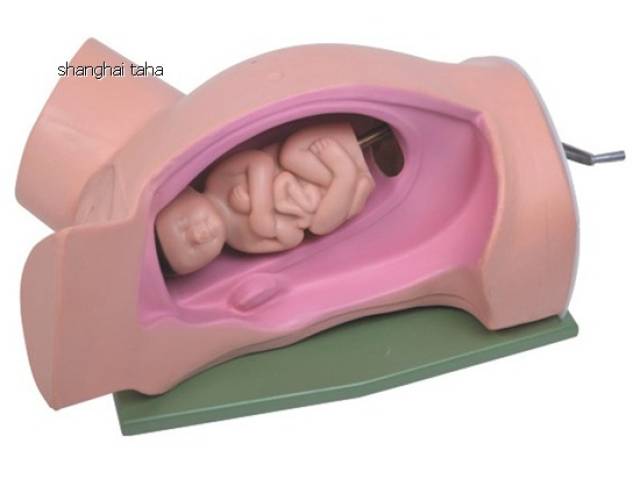 分娩机转,胎儿,内旋转,前后径,qy-mi3正常分娩机转演示教学设备