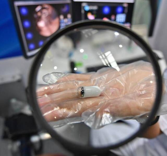 磁控胶囊胃镜舒适化癌症筛查的践行者