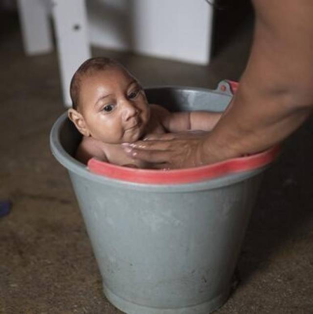 蚊虫叮咬传播"寨卡"病毒,导致婴儿小头症!孕妈如何防治