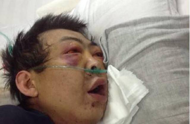 江苏化工厂苯爆炸,"苯"有多可怕,面对苯中毒我们如何自救?