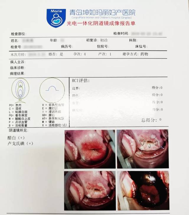 宫颈锥切前后图片对比图片