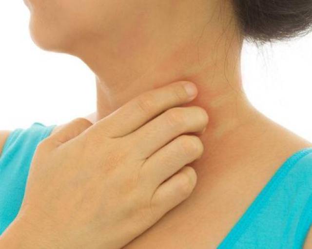 皮肤瘙痒别不在意,若出现这5种情况,警惕皮肤癌的发生