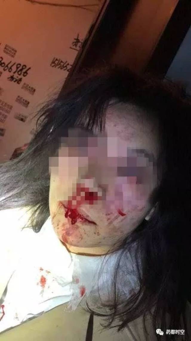 愤怒!亳州一男子暴打妻子!5岁女儿揭穿隐情.
