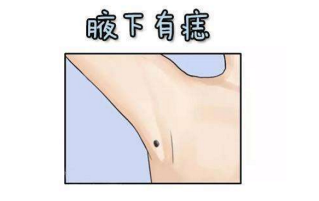 痔的位置与命运：腋窝长痣代表什么？_工作