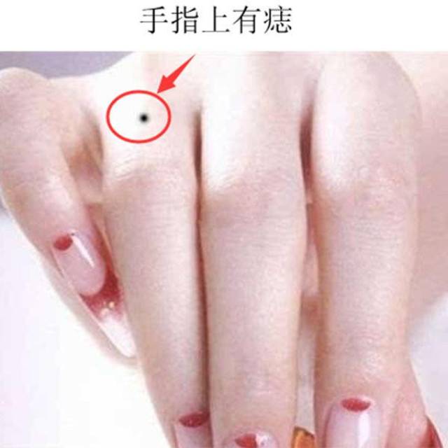 女人右手食指有痣图解图片