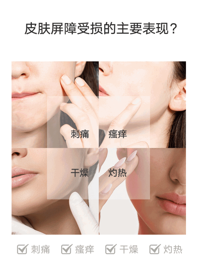 不错!皮肤屏障受损,皮肤问题百出.