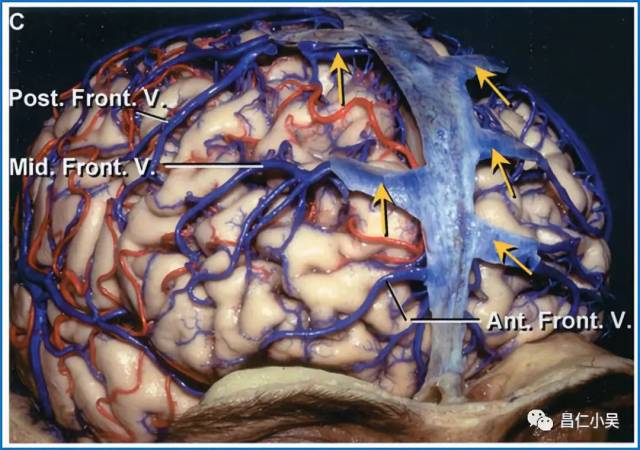 解剖學習筆記 | 腦靜脈