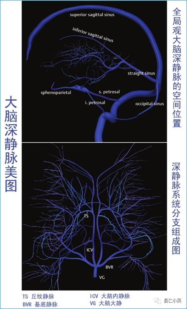 大脑静脉系统解剖图图片