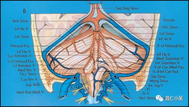 头颅静脉及静脉窦解剖图片