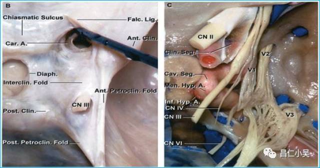 解剖学习笔记 | 脑静脉