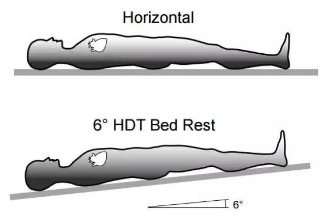头低卧位图片
