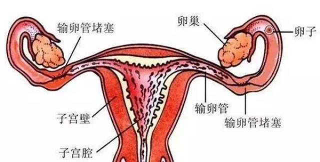 多囊卵巢综合征妇女喜获龙凤胎的心路历程