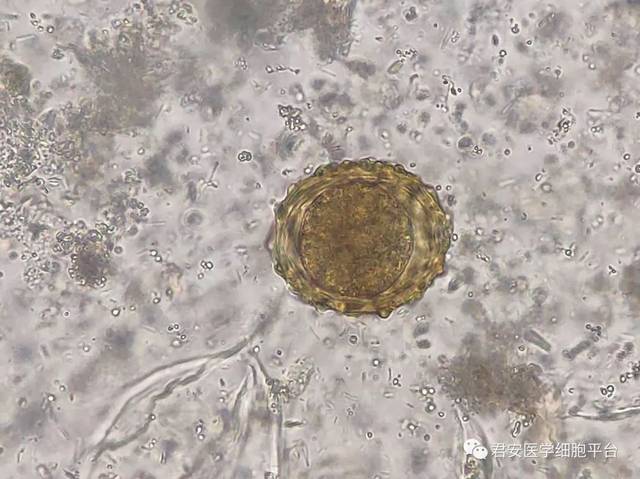 显微镜下的蛔虫卵图片