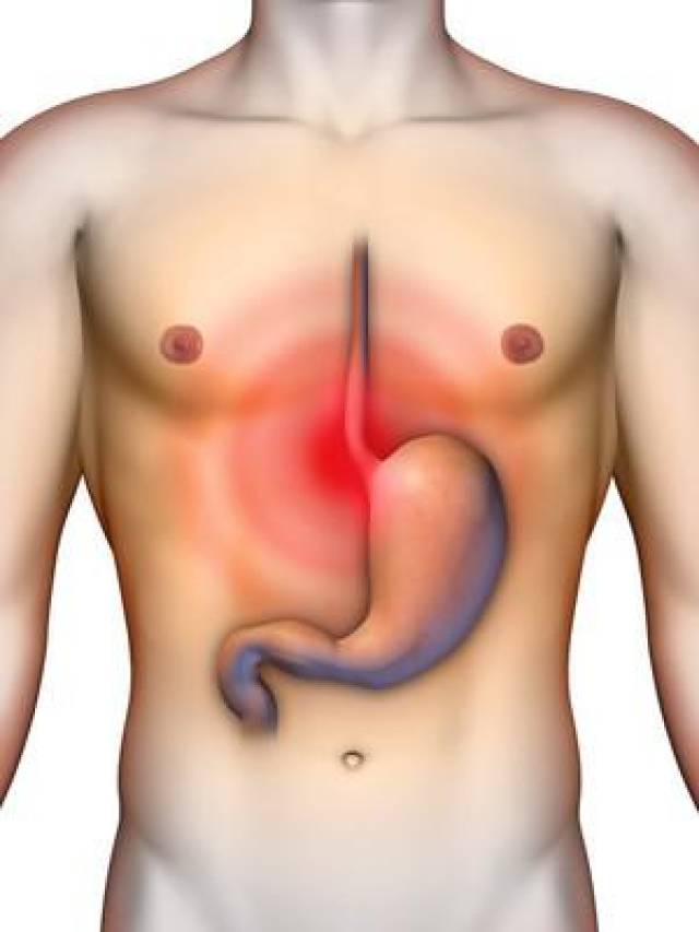 食管反流胸疼的位置图图片