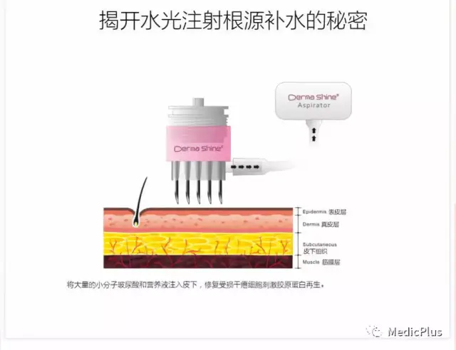 韩国最新研制的德玛莎derma shine 2代水光注射仪器,采用负压技术