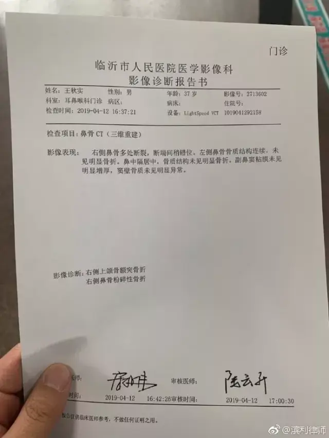 山东律师执业时被打,鼻骨粉碎性骨折!