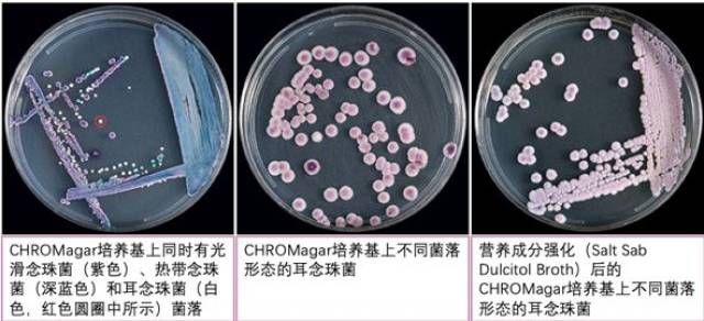 華山感染專家帶您走進耳念珠菌