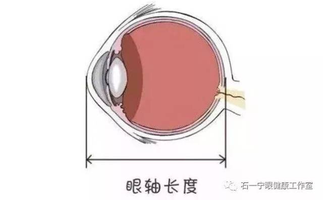 从出生不到16mm的眼球长度一直持续发育到20岁,长到24mm左右(如下图)