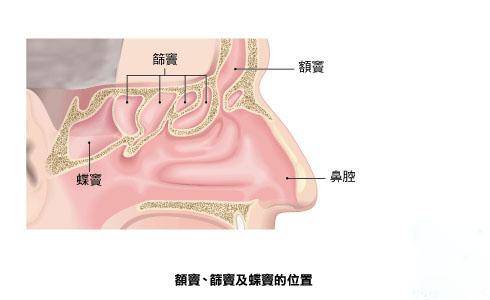 双侧筛窦炎图片位置图片