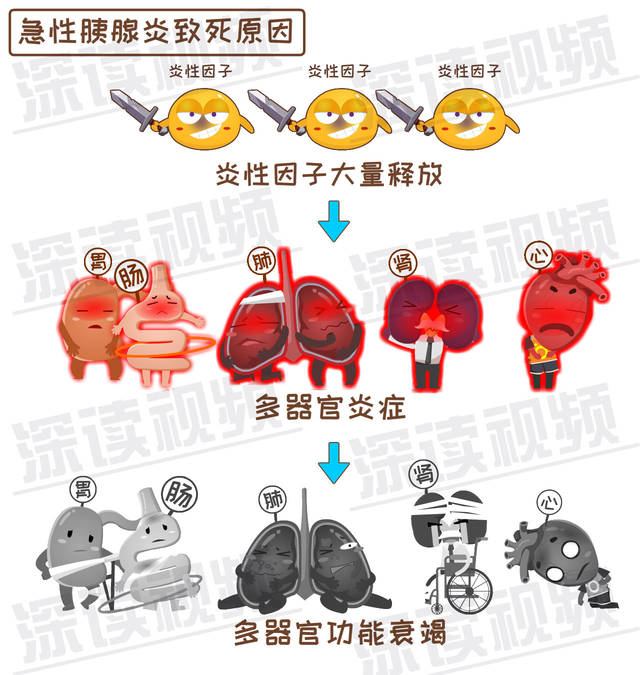 致死腹痛背后真相是啥?胰腺炎发病机制动漫版!