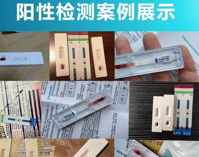 艾滋病感染後有哪些症狀,hiv試紙可以檢測出來麼?