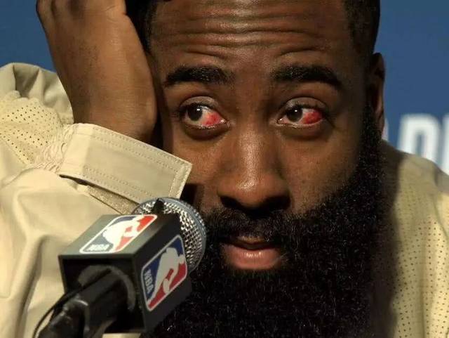 篮球恐怖受伤掉眼珠图片