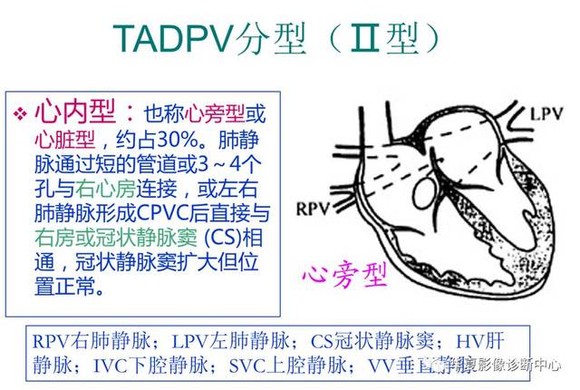 肺静脉异位引流图片