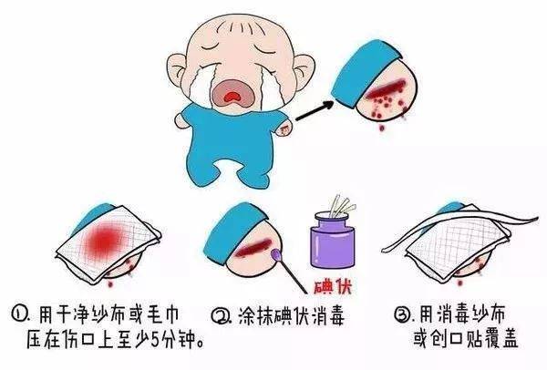 我院皮肤科代玉柱医生说到:在做擦伤创口包扎时,应在创口消毒后用喷有
