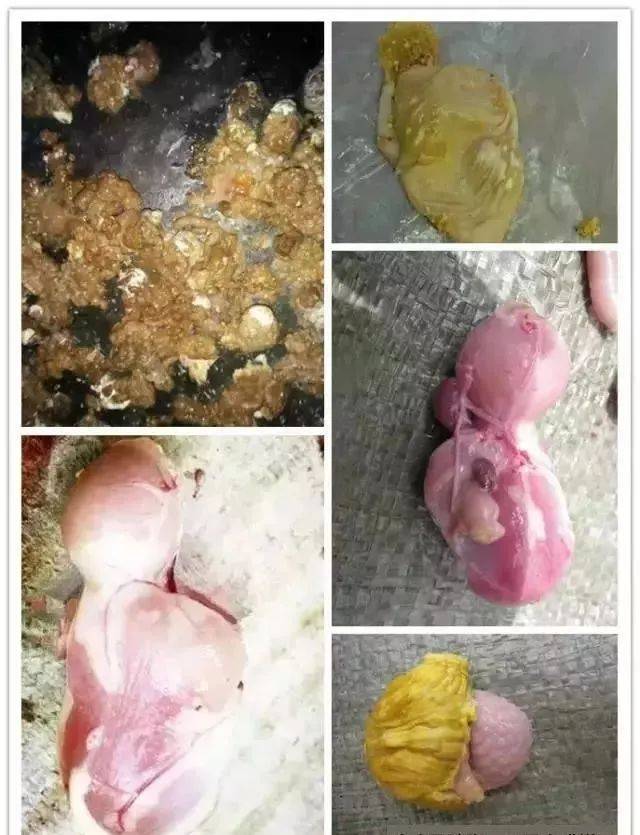 1,腺胃,肌胃比例严重失调 2,腺胃粘膜肿胀变厚,外观有菱形的网格线,腺