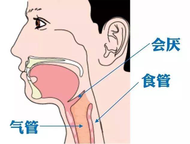 紫金5岁男童吃三华李噎住喉咙窒息身亡?这里有最有效的救命方法