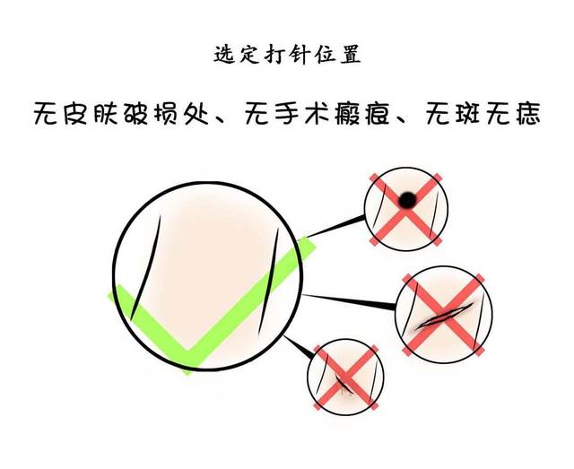 《阿木说》第一期:肝素的注射教程 (原创)
