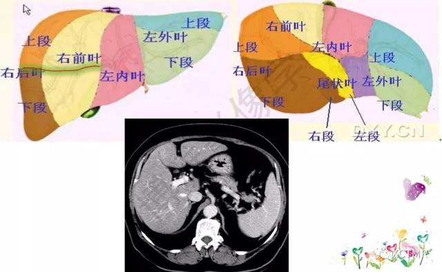肝脏分叶分段解剖图ct图片