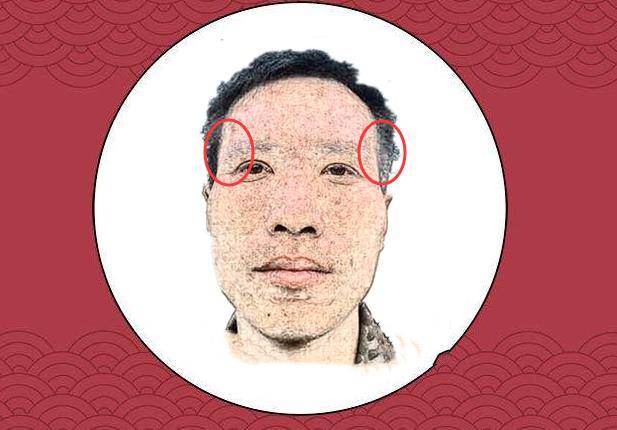 天仓凹陷所谓的天仓就是指太阳穴的位置,即眉尾与