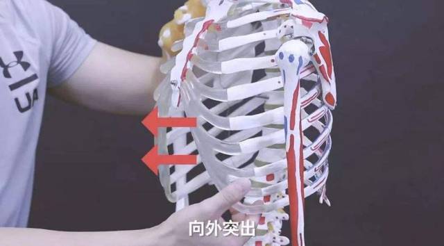 身体仰卧 肋骨最下缘明显突出身体 就是肋骨外翻