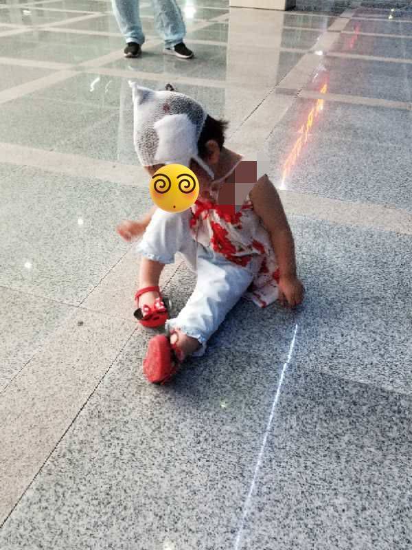 龙华某一岁半幼童小区玩耍,被天降铝罐砸破脑袋.