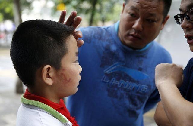 杨八里:男子狠踩小孩受伤脚部,先来岂是欺凌弱小理由_手机搜狐网