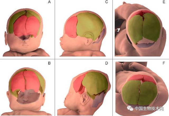 3d成像揭示胎儿在出生时如何改变头部形状