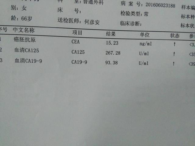 ca199升高是有腫瘤嗎?一文為您深度解讀