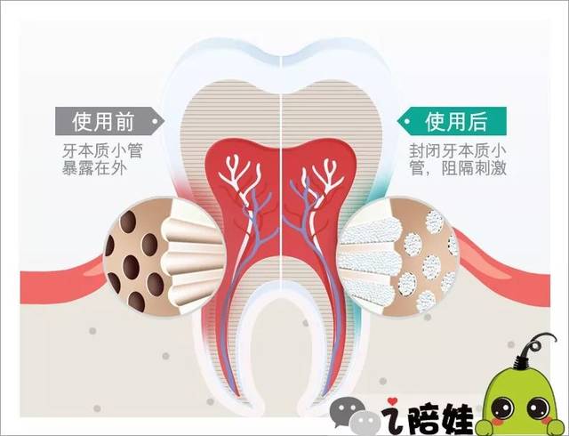 甚至牙齒敏感嚴重時,可以擠點直接抹牙上急救.