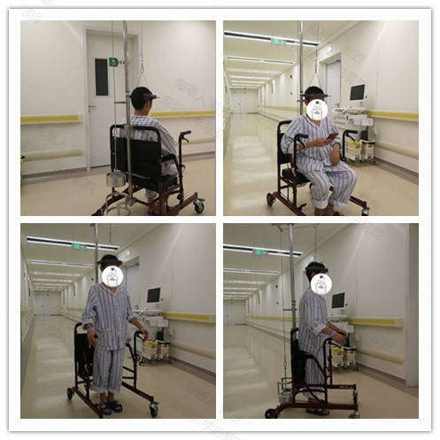 重度脊柱侧弯术前舒适高效的halo头环牵引技术问答!