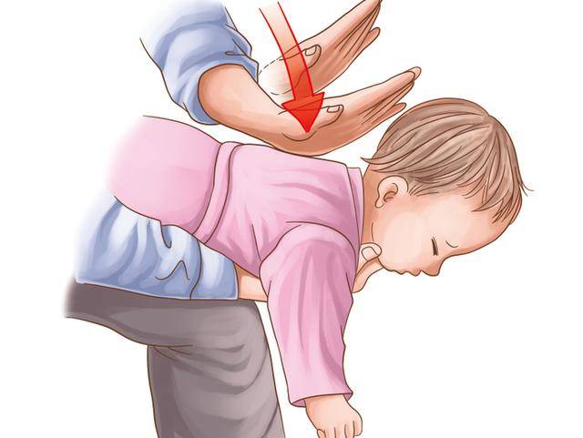 家长必知孩子吞了异物一定要这样做