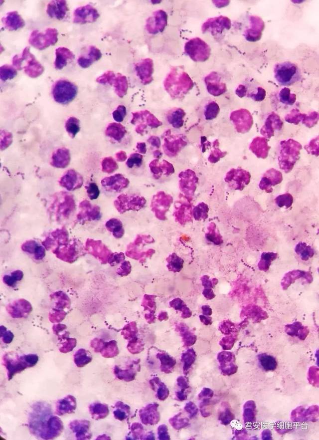 乳酸链球菌显微镜图片图片