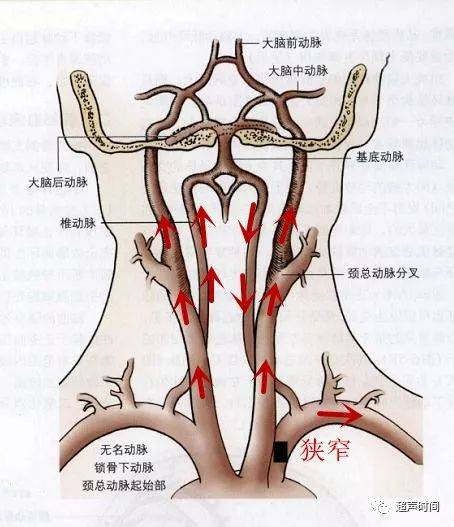 超声新手福利 锁骨下动脉盗血综合征 左侧锁骨下动脉隐匿行盗血 男霸网