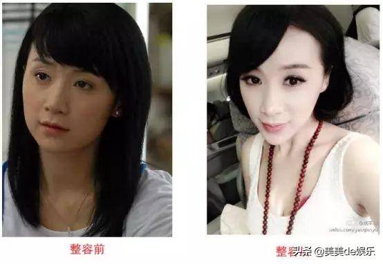 当红大女主削骨失败,拒走红毯!杨幂给她作