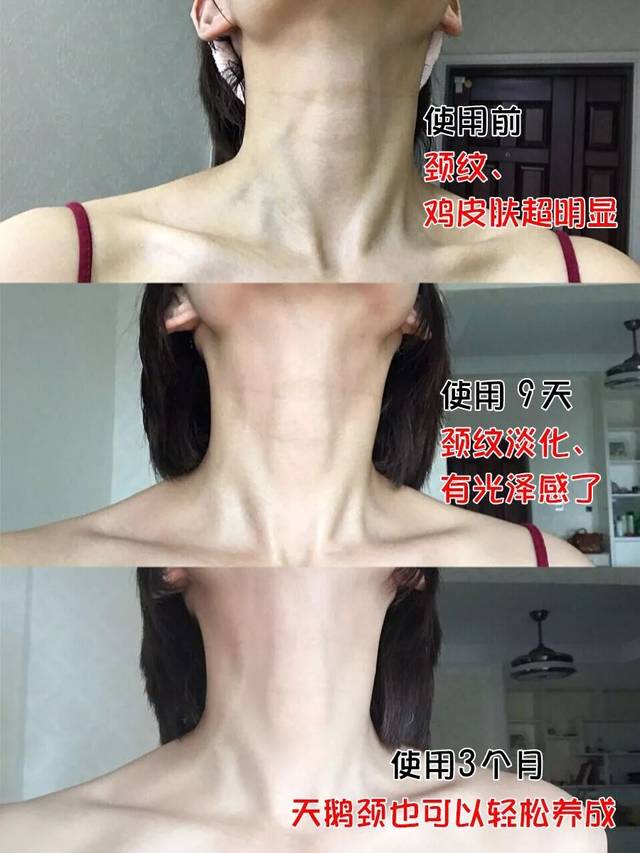 女性正常脖子图片大全图片