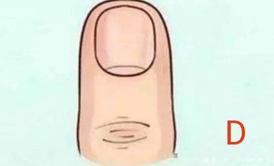 ●试试看准不准!你中指是什么形状?决定你是什