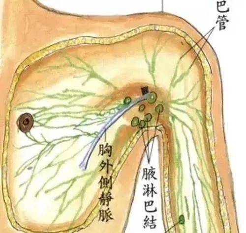 咯吱窝长了小肉球图片图片